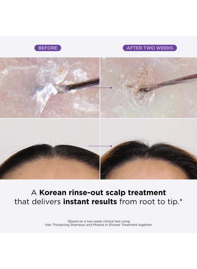 Dr.Groot Dr. Groot Miracle in Shower Treatment for Hair Loss, Korean Hair Care, 5 Seconds to Smooth Hair, Rosemary Oil for Healthier-Looking Hair, Hair Rinse, Moisturizing Treatment,Scalp Revitalizing Solution - Image 2