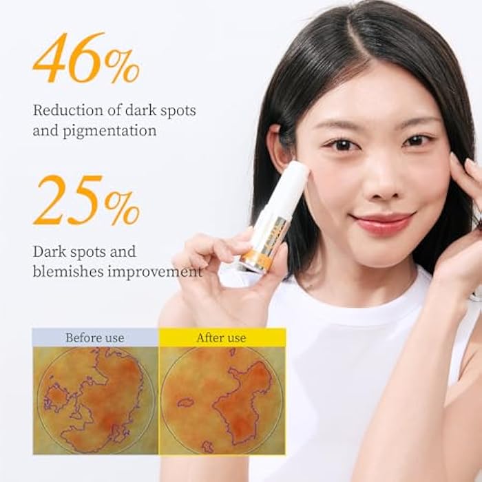 YADAH Vitamin C 30 Correcting Balm (0.35oz) – All-in-one Multi Care for Dark Spot Remover, 30% Pure Ascorbic Acid & Vitamin E for Radiant Nourished Skin, Starter & Finishing Balm and Skin Brightening - Image 3