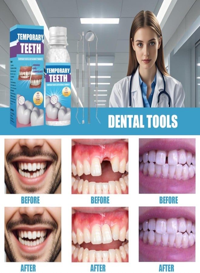 NUSQO Tooth Repair kit with 4 Dental Tools, Easy-to-Use for Men & Women,Dental Care Kit Fixing Broken Teeth, Save Smile Cause Bad Teeth and Smile Confidently Again - Image 3