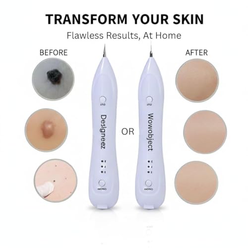 Designeez Electric Freckle Skin Mole Dark Spot Remover Pen Skin Tag Remover Dark Spot Wart Speckle Tattoo Removal Pen Multi-Speed Adjustable Skin Care Instrument - Image 2