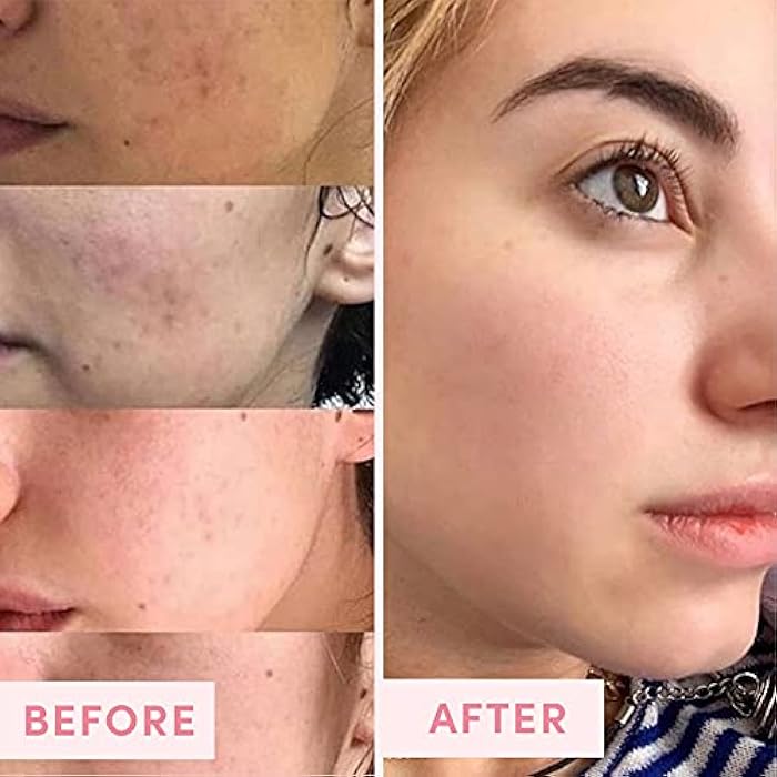 Sand & Sky Australian Pink Clay Detoxifying Face Mask with Vitamin C & Antioxidants - Pore Clearing Clay Mask for Blemish-Prone Skin, Fades Hyperpigmentation & Evens Tone - Image 5