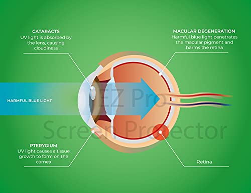 EZ-Pro Screen Protector Premium Anti Blue Light and Anti Glare Screen Protector (2 Pack) for 15.6 inches Laptop with Aspect Ratio 16:9. Easy and Bubble Free Installation - Image 4