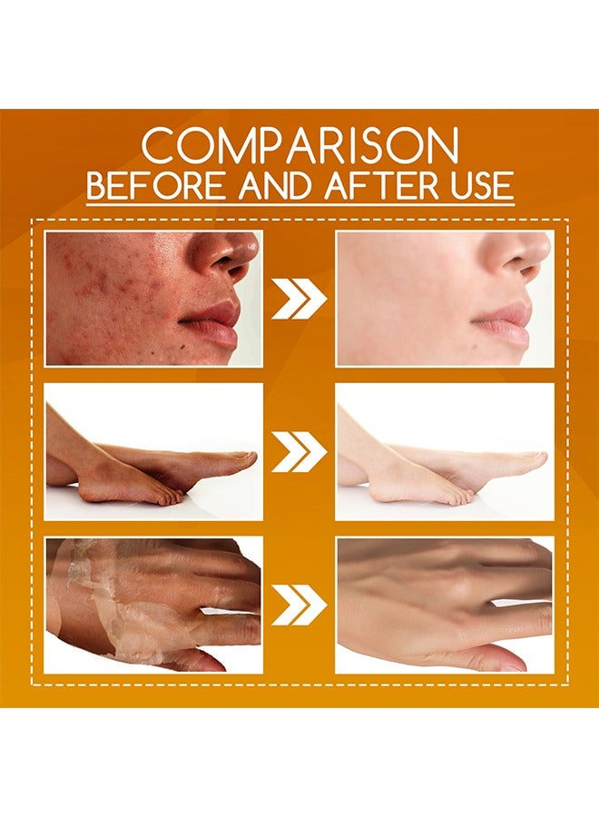 OUHOE Orange Peeling Lotion，Body Lotion Gentle Skin Exfoliation Fading Dark Spots Whitening Skin Moisturizing Care Solution 100ml - Image 3