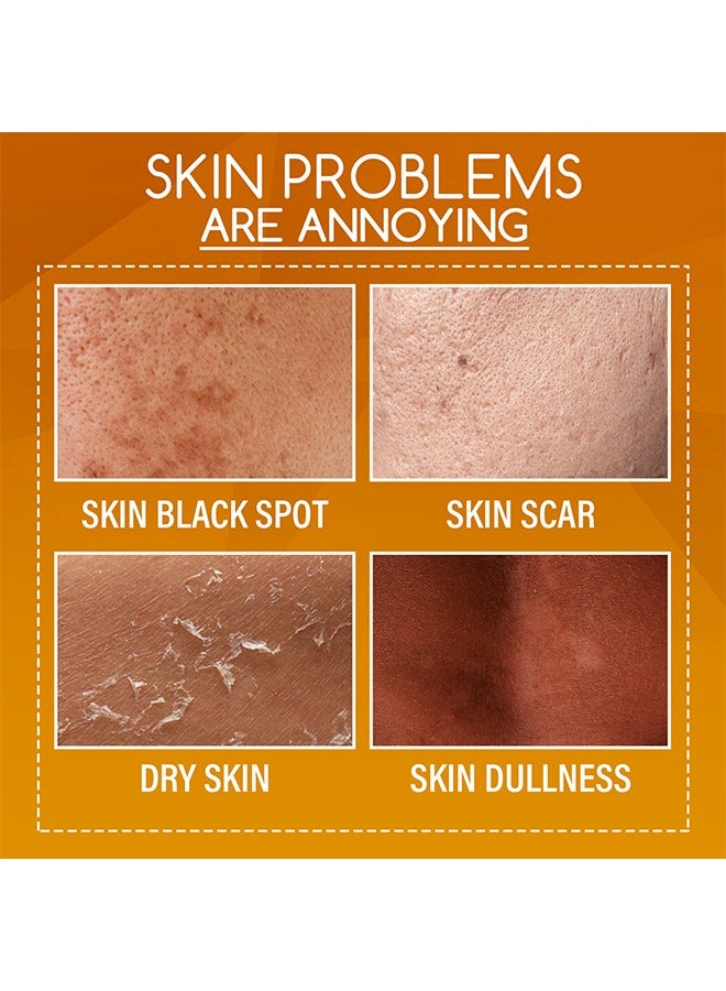 OUHOE Orange Peeling Lotion，Body Lotion Gentle Skin Exfoliation Fading Dark Spots Whitening Skin Moisturizing Care Solution 100ml - Image 4