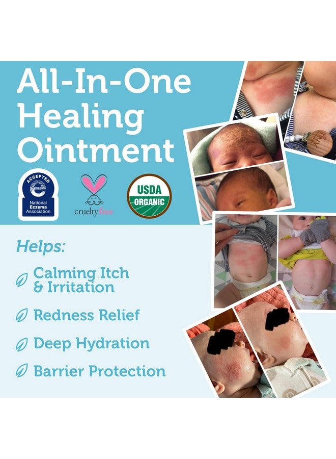 Era Organics Era Organics Healing Ointment for Babies - USDA Certified Organic Natural Moisturizer Gentle on Sensitive Skin Prone To Baby Eczema, Cradle Cap (Infant Seborrheic Dermatitis), Rashes, Hives and More - Image 4