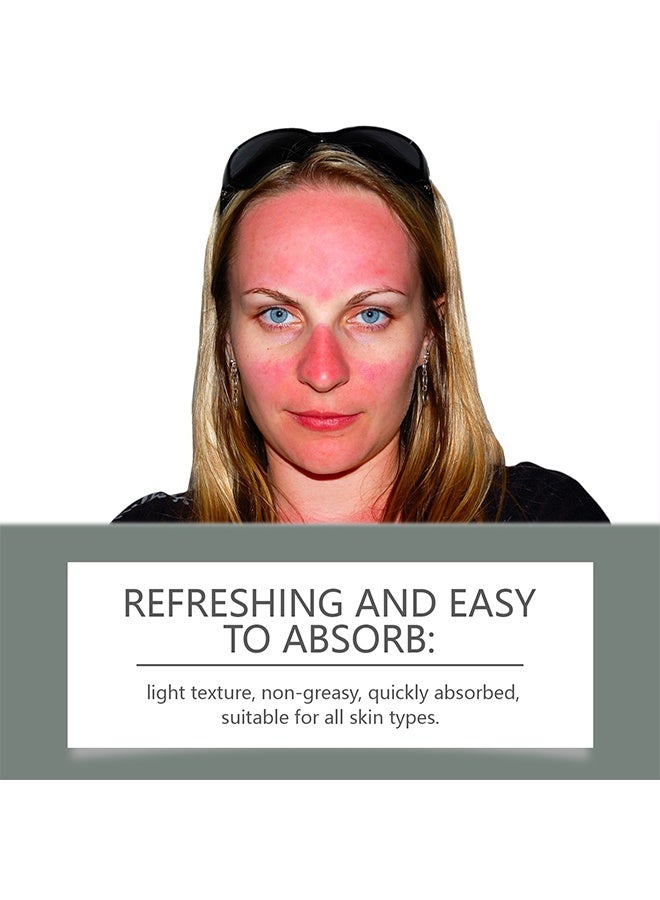 OUHOE Moisturizing And Translucent Sunscreen，Silky Moisture Sunscreen, Korean SPF 50+ PA++++ Clear Filter Sun Essence, Moisture Daily Sunscreen, No White Cast&Sticky, Hydrating, Moisturizing,Light Finish Universal Sun Essence for All Skin 50G - Image 3