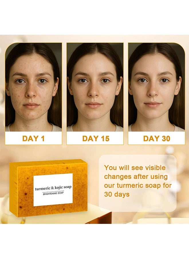 Kojic Soap Turmeric Soap for Spots Remover - Honey Lemon Turmeric Kojic Soap Bar for Face and Body, Organic Daily Use Skin Care Soaps, Evens Skin Tone Deep Cleansing Moisturizing (3pcs) - Image 2