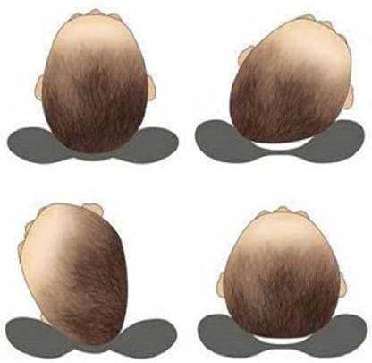 Chinmay Kids New Born Baby Soft Head Pillow with Mustard Seed, 0-3 Years Age Group, Pack of 2 (Red- Yellow) - Image 4