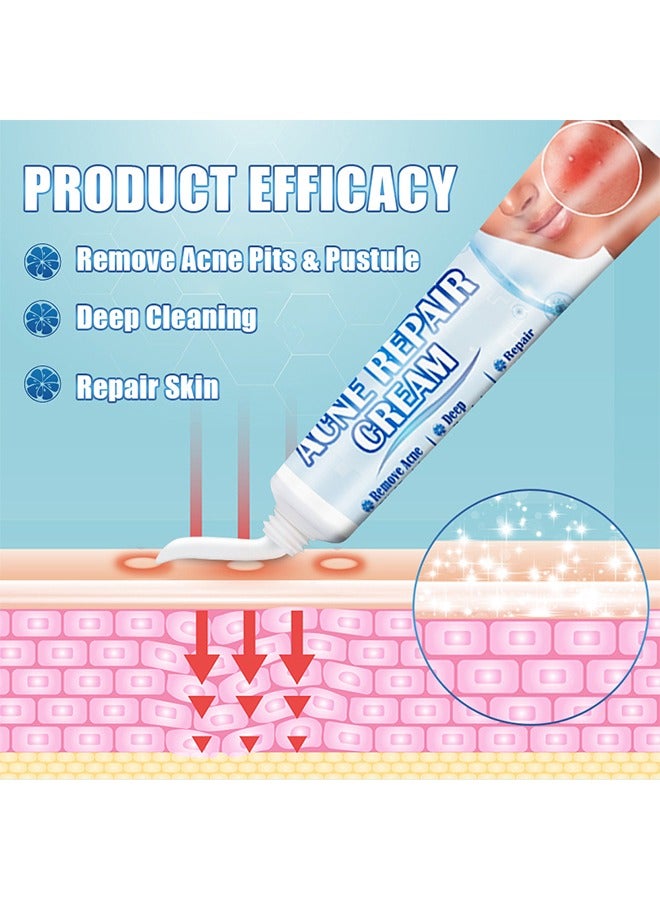 Sumifun Acne Repair Cream - Acne Removing Cream Repairs Acne Pits, Lightens Acne Marks and Spot Removing Cream Moisturizes and Shrinks Pore Set,Day and Night Use 20g - Image 3