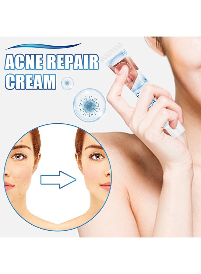 Sumifun Acne Repair Cream - Acne Removing Cream Repairs Acne Pits, Lightens Acne Marks and Spot Removing Cream Moisturizes and Shrinks Pore Set,Day and Night Use 20g - Image 2