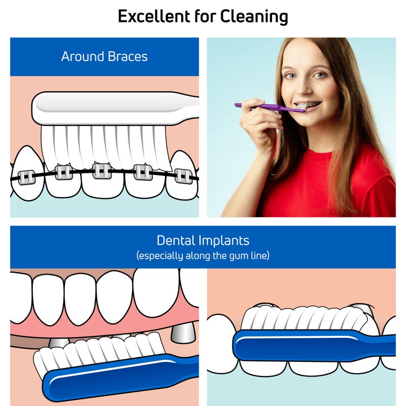 TePe Implant Orthodontic Soft Toothbrush â€“ Extra Narrow Brush Head Thin Neck 1Pk - Image 3