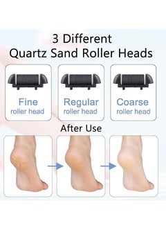General Electric Callus Remover for Feet, Rechargeable Pedicure Tools Foot Care Feet File, 13 in 1 Callous Remover Kit for Remove Cracked Heels and Dead Skin, with 3 Roller Heads 2 Speed, Battery Display  - Image 4