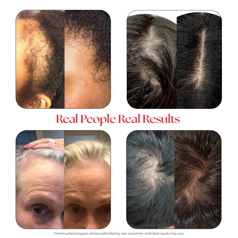 HAIRtamin Scalp Serum Natural Hair Growth Thickening | Made in USA | Helps Increase Hair Thickness and Aids Against Hair Thinning and Hair Fall Out | Moisturizes and Soothes Dry Itchy Scalp - Image 3