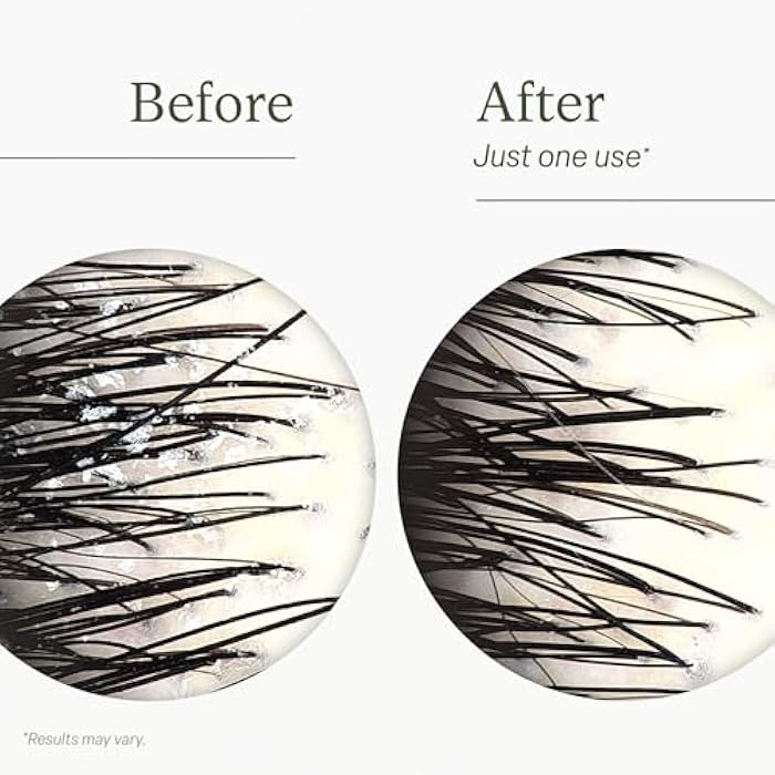 Divi Clarifying Scalp Reset Shampoo and Whipped Repair Treatment Mask Set, Deep Cleansing, Oil Control, Bond Repair, Full Size, 2 Piece Set - Image 5