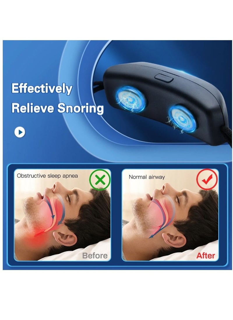 Generic - Smart Anti Snoring Device EMS Portable Stop Snoring Device Comfortable Sleep Health Care Sleep Apnea Aid USB - Image 1