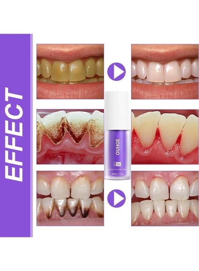 OUHOE Teeth Color Corrector Serum, Purple Teeth Brightening Toothpaste, Remove Stains, Teeth Brightening Purple Toothpaste, Remove Coffee, Stains, Yellow Teeth (30ML) - Image 3