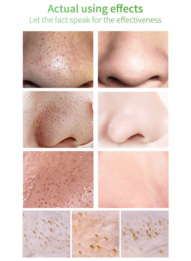 Labymos Blackhead Removal Kit Deep Pore Cleansing and Shrinking Blackhead Liquid Remover Green Tea Blackhead Solution Nose Pore Minimizing Peel Kit