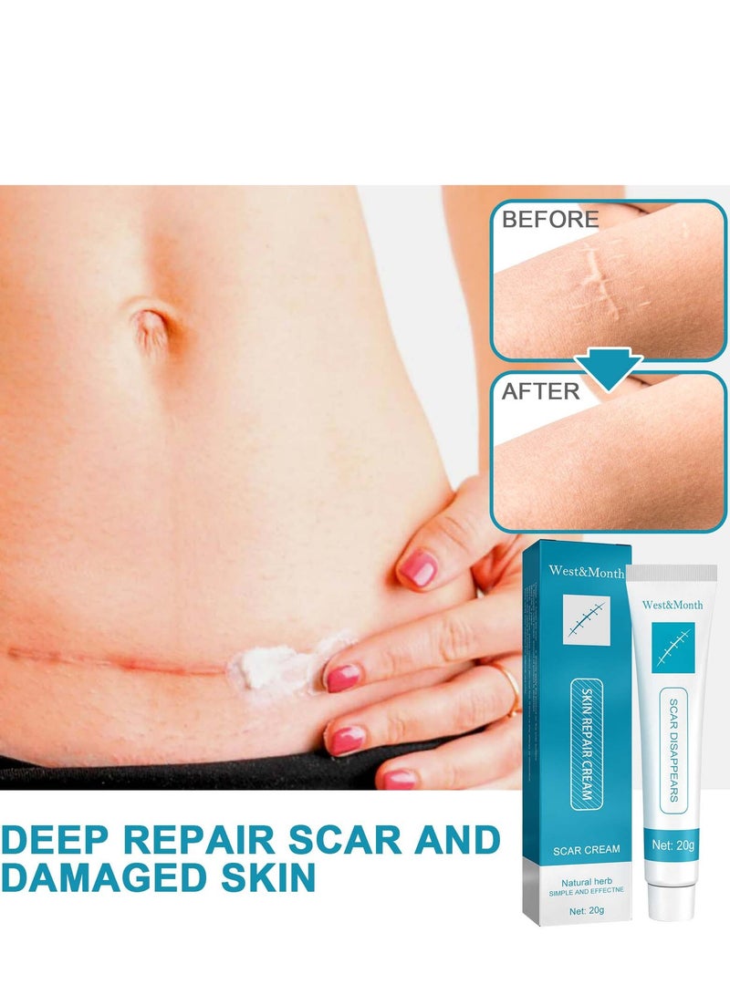 West&Month Scar Repair Cream Dilute Hyperplasia Pregnancy Surgery Burn Scald Skin Repair Scar Cream 20g - Image 5