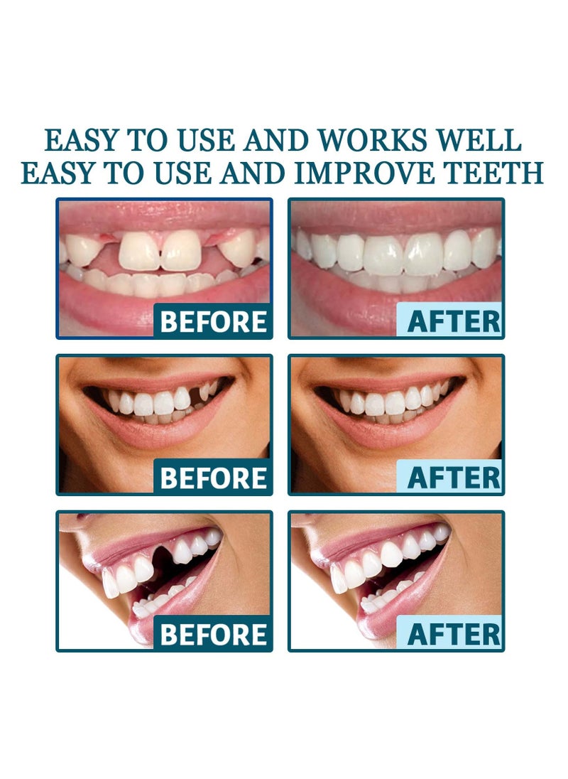 Generic Fake Teeth, 2 PCS Veneers Dentures Socket for Women and Men,Covering Imperfect Teeth,Nature and Comfortable Veneers to Regain Confident Smile.  - Image 4