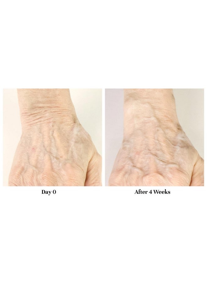 City Beauty Restoring Hand Treatment - Moisturizing Hand Cream - Dry Hand Relief - Solution For Wrinkled, Crepey Hands & Dark Spots - Wash-Resistant - Anti-Aging Cruelty-Free Skin Care - Image 2