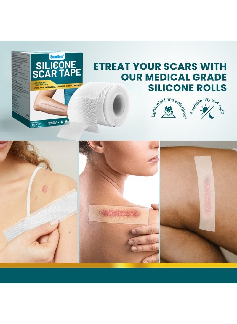 Sumifun Wound Repair Scar Patch, Surgical Scar Removal Patch, Sports Trauma Scar Care Patch(4*150cm)  - Image 2