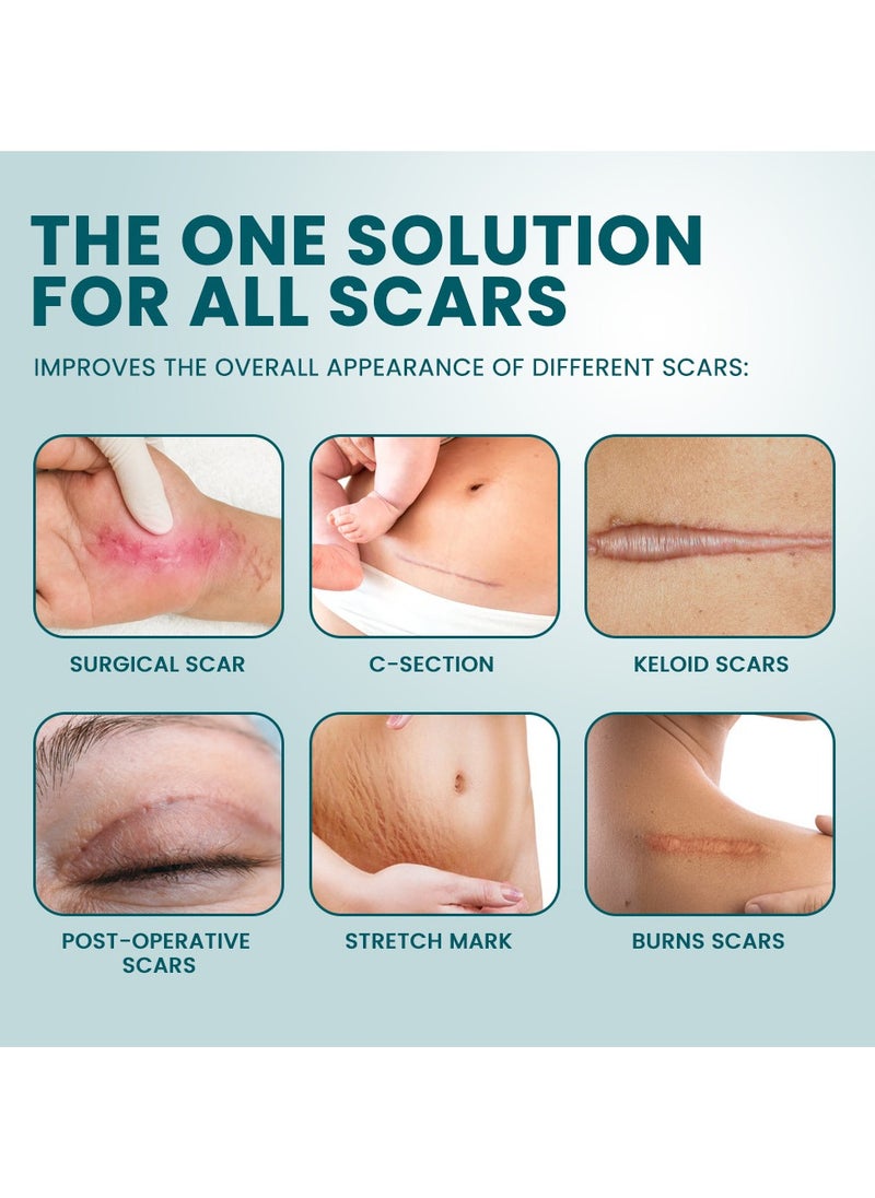 Sumifun Wound Repair Scar Patch, Surgical Scar Removal Patch, Sports Trauma Scar Care Patch(4*150cm)  - Image 4