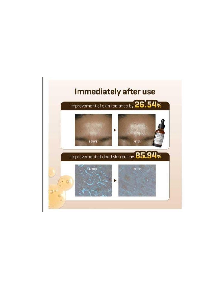 سام باي مي Some by Mi Serum with Pure Vitamin C and Galactomyces for Radiant Skin, 30 ml, by Some by Mi, Unisex 30mlml - Image 3