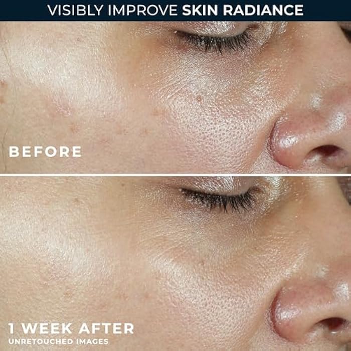 RoC Multi Correxion Revive + Glow Vitamin C Sunscreen Broad Spectrum SPF 30 Face Moisturizer (1.7 oz) with Retinol Eye Cream Packette - Image 5