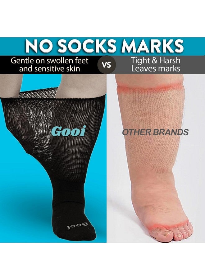 Gooi Gooi Extra Wide Socks for Swollen Feet Soft Stretch to 30" Seniors Diabetics Men Women 10-13 13-15 Non Binding Loose Fit Top Edema Lymphedema Neuropathy Bariatric Cover Cast Over The Calf Plus Size - Image 5
