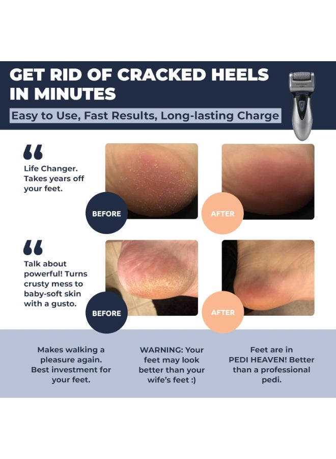 Own Harmony Electric Callus Remover for Feet: Best Pedicure Tools for Men by Own Harmony with 3 Rollers (Powerful), Electronic Pedi Spa Foot File Care - Perfect for Hard, Cracked, Dry, Dead Skin (USB Cable) - Image 2