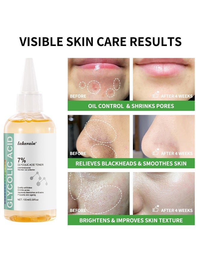 lakerain 7% Glycolic Acid Toner, Removing Acne, Reducing Acne Marks, Removing Closed Mouth Acne, And Repairing The Skin, Exfoliating Serum For Face, Hydrates And Reduces Skin Blemishes, 100ML - Image 2