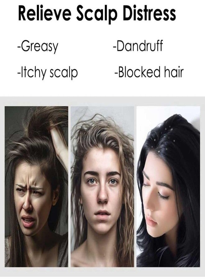 MATSON Dandruff Comb Energy Massage Comb Scalp Brush for Dandruff Removal, Lice Remover Products, Hair Dressing Comb, Plastic, Brown, Unisex - Image 5