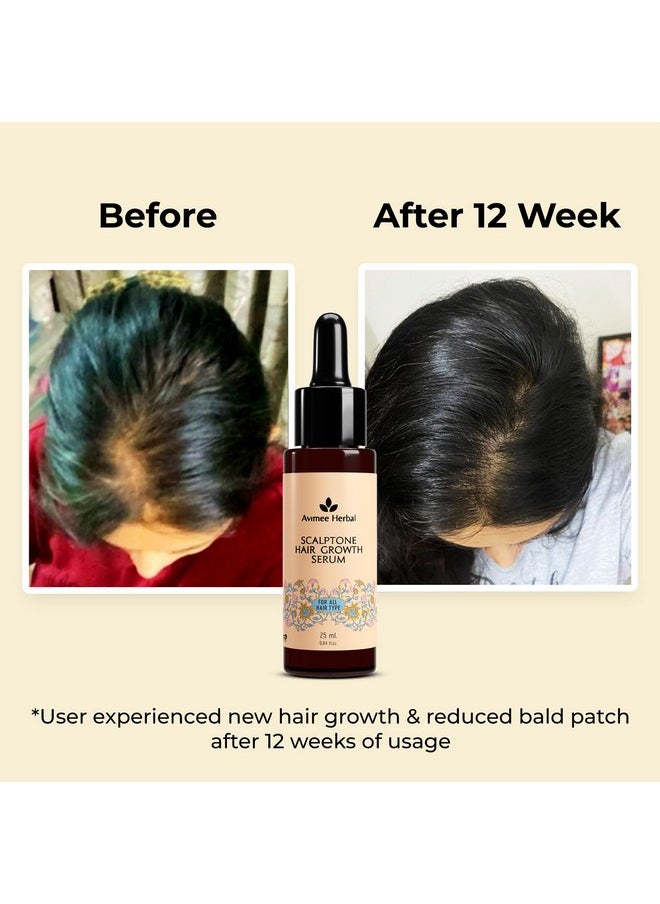 AVIMEE HERBAL - Scalptone Hair Growth Serum | Scientifically Proven Formula | Enriched With Nansyl & Green Tea Extract | For Hair Growth & Hair Fall Reduction | 25 Ml - Image 1