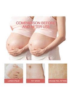 CARVENCHY Stretch Mark Oil Natural Formula - 100% Natural Pure Plant Extract 30ML- Stretch Marks Remover, Essential Oil Skin Care Treatment For Stretch Mark, Removal Maternity Slackline & Scar Removal 30ml  - Image 3