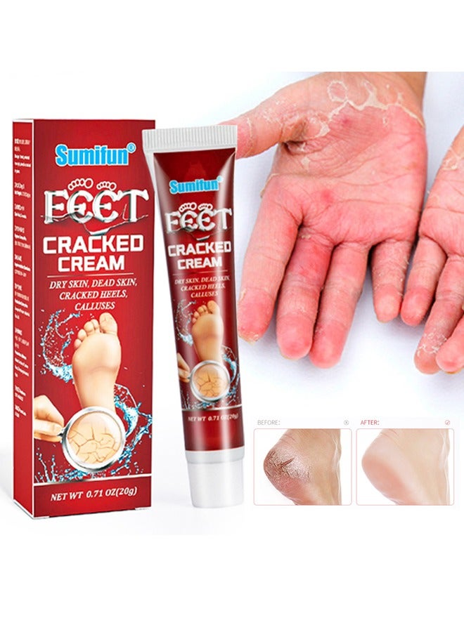 سوميفون كريم متشقق للقدم ، كريم ترطيب مضاد للتشقق للقدم واليدين ، كريم إصلاح مكثف للقدم ، مرهم شفاء البشرة للكعب المتشقق والقدمين الجافة 20 جرام - Image 1