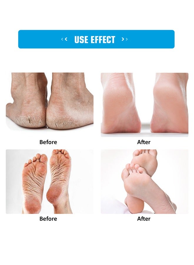 سوميفون كريم متشقق للقدم ، كريم ترطيب مضاد للتشقق للقدم واليدين ، كريم إصلاح مكثف للقدم ، مرهم شفاء البشرة للكعب المتشقق والقدمين الجافة 20 جرام - Image 5