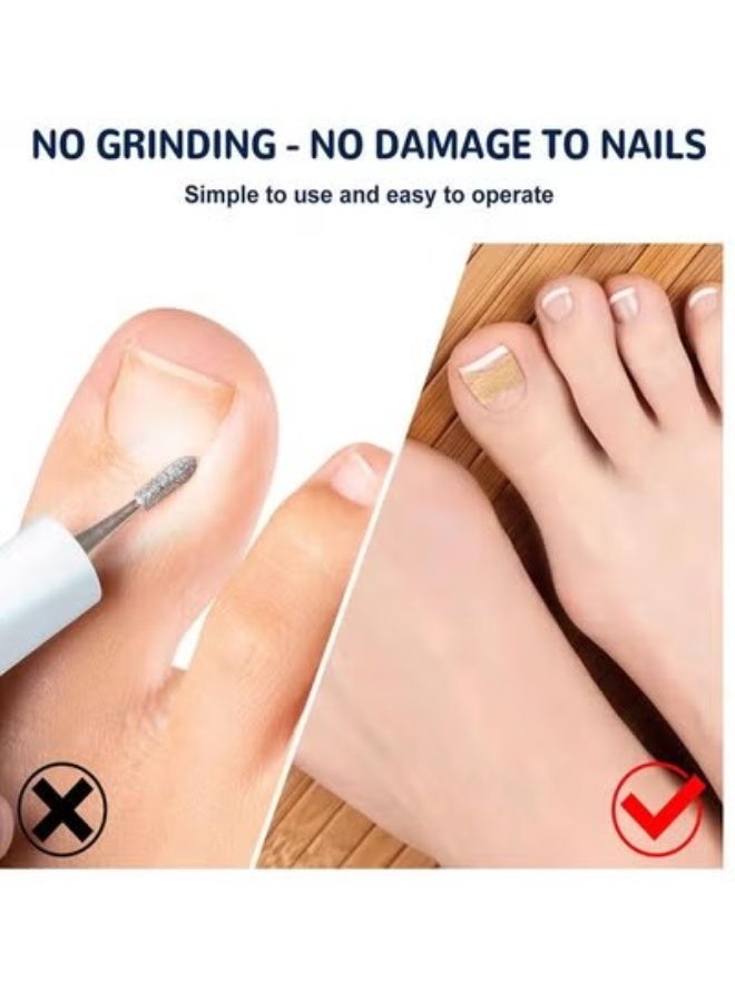 إيلهو تصحيح اصبع القدم و اظافر اصبع القدم - Image 5