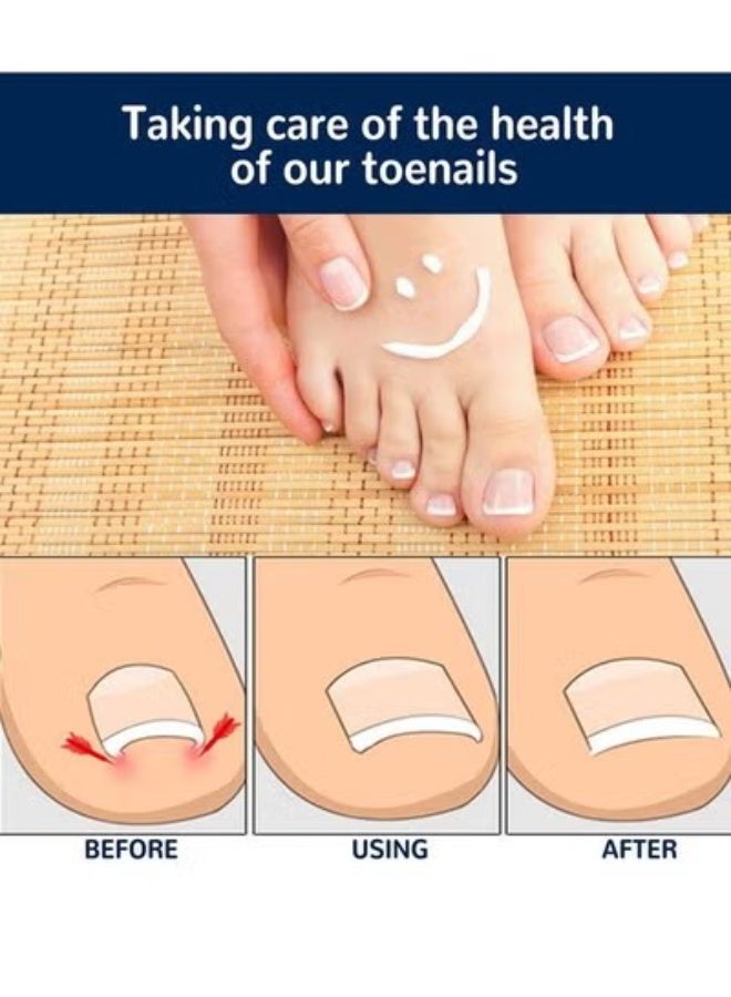 إيلهو تصحيح اصبع القدم و اظافر اصبع القدم - Image 3