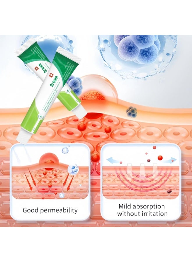 SYOSI Anti-Itch Cream (2pcs), Moisturizing Soothing Cream for Itchy Skin Relief – Chinese Herbal Formula for Men and Women – Calms and Relieves Irritated Skin - Image 4