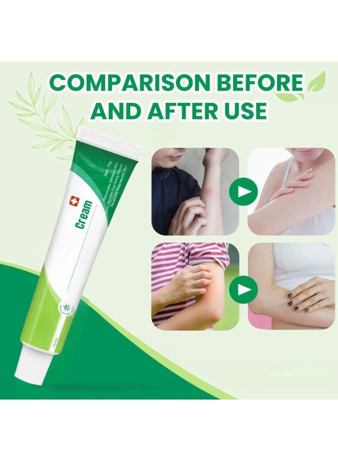 SYOSI Anti-Itch Cream (2pcs), Moisturizing Soothing Cream for Itchy Skin Relief – Chinese Herbal Formula for Men and Women – Calms and Relieves Irritated Skin - Image 2