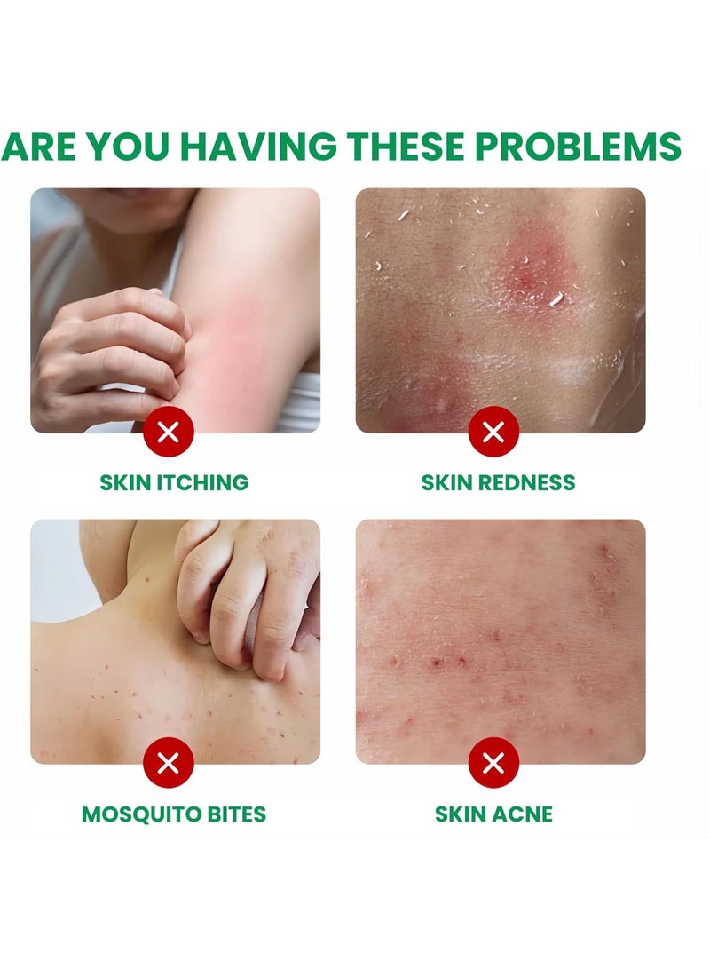 SYOSI Anti-Itch Cream (2pcs), Moisturizing Soothing Cream for Itchy Skin Relief – Chinese Herbal Formula for Men and Women – Calms and Relieves Irritated Skin - Image 5