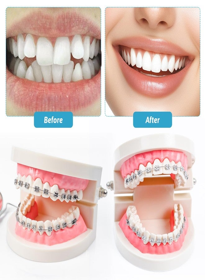 طقم تقويم أسنان صناعي (عبوة من قطعتين)، طقم تقويم أسنان مع دعامات وأسلاك وغراء، دعامات أسنان، مثبت أسنان يمكنك تركيبه بنفسك، أدوات تدريب لطلاب طب الأسنان (أزرق) - Image 3