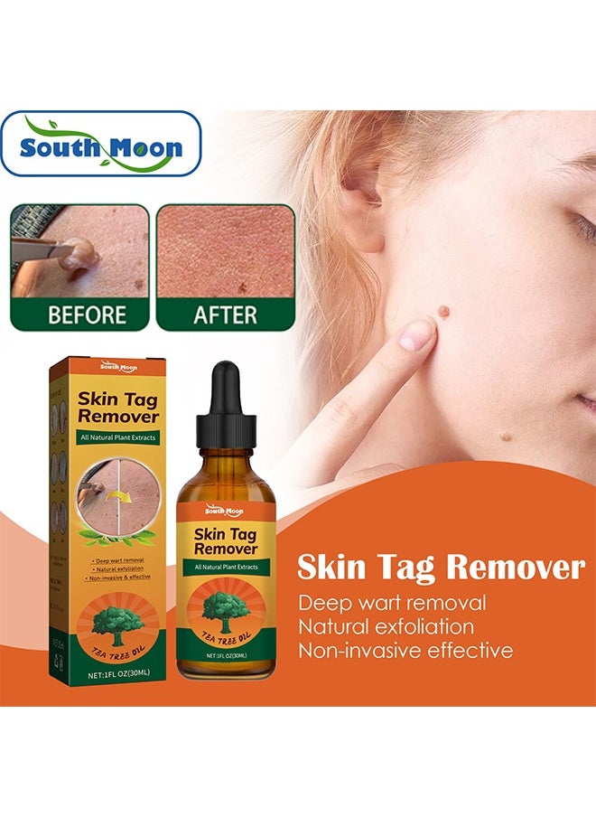 SOUTH MOON Skin Tag Remover - Wart Remover Fast Acting & Effective Wart Removal Treatment for All Skin Type 30ml  - Image 1