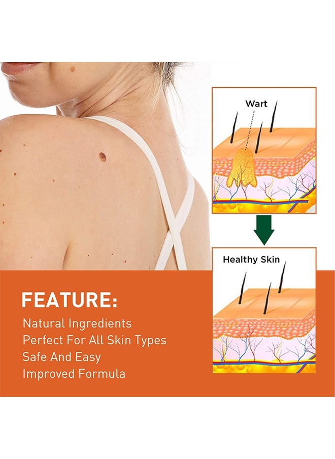 SOUTH MOON Skin Tag Remover - Wart Remover Fast Acting & Effective Wart Removal Treatment for All Skin Type 30ml  - Image 5