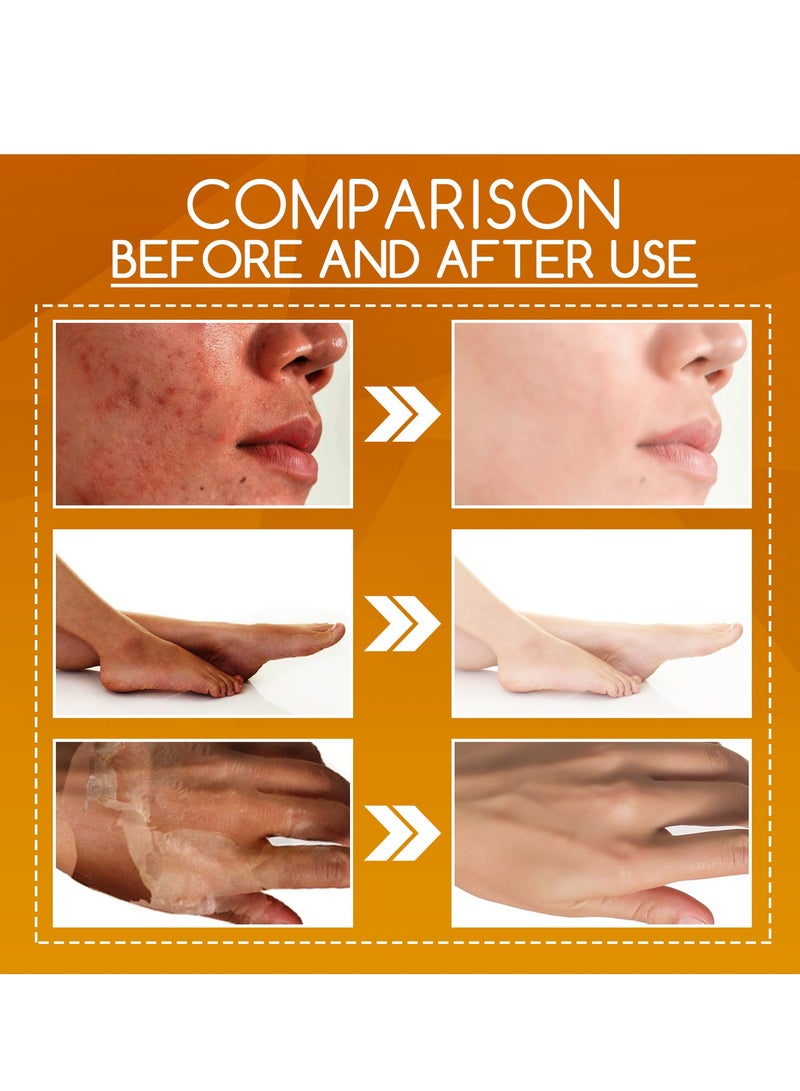 OUHOE Orange Peel Body Lotion Gentle Skin Exfoliation Fading Dark Spots Whitening Skin Moisturizing Care Solution 100ml - Image 2