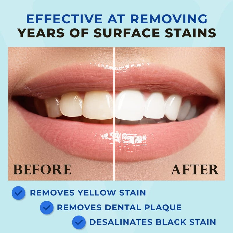 Venus Visage قلم تبييض الأسنان الحائز على جائزة فينوس فيساج، 20+ استخدام - جل تبييض الأسنان مصمم بشكل احترافي - أفضل قلم جل لتبييض الأسنان - منخفض الحساسية (نعناع) (0.07 أونصة سائلة (عبوة من 2)) - Image 2