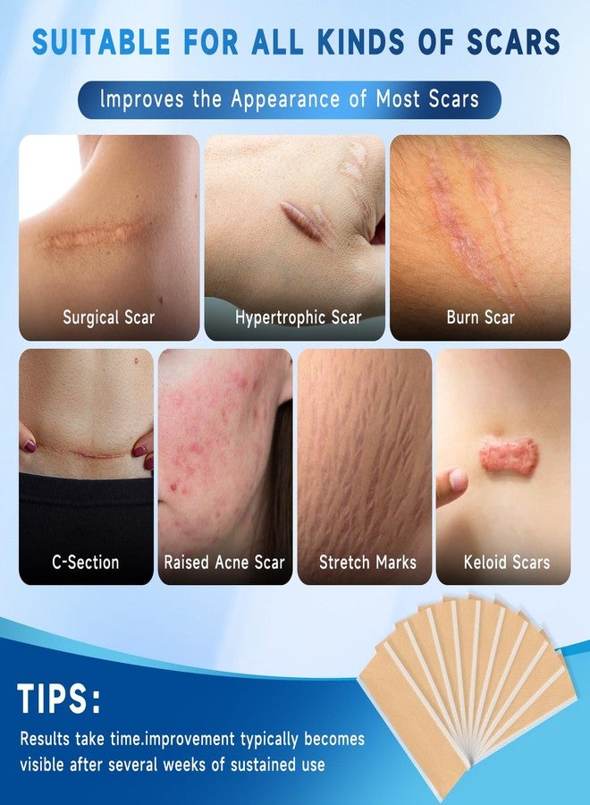 Rvlaim Silicone Scar Sheets, Silicone Scar Tape(5.7” x 1.57” 10 Pcs, Silicone Scar Sheets for Surgical Scars, Keloid Bump Removal, Stretch Marks Removal, C-Section, Burn et - Image 3