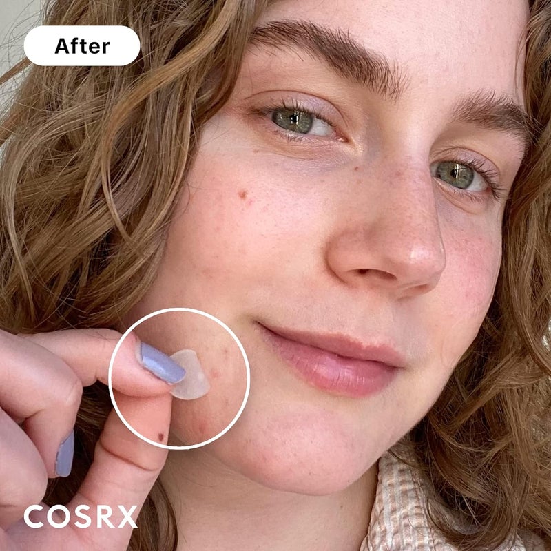 كوسرإكس COSRX Acne Pimple Master Patch - Face - 24 Patches (3 Sizes) - Unscented - Image 2