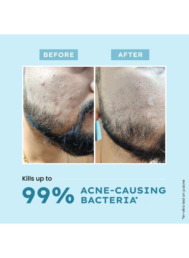 Hyphen Clarifying Acne Face Wash for Women and Men | Cleanser For Acne Prone Skin with Salicylic Acid 2%, Zinc PCA, Witch Hazel 10% | Oil Control Pore Cleasning | Antibacterial & Non-Drying - 100ml - Image 4