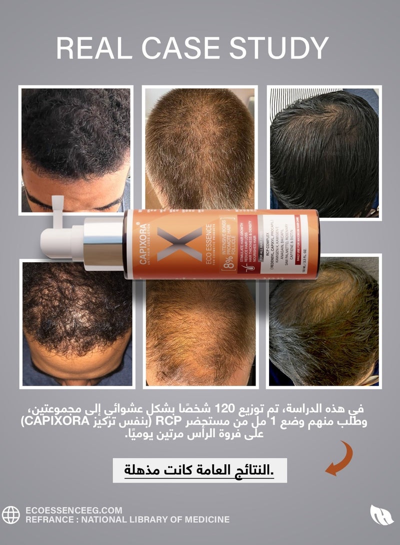 Capixora Capixora anti hair loss lotion natural and powerful formula for men and women - Image 4
